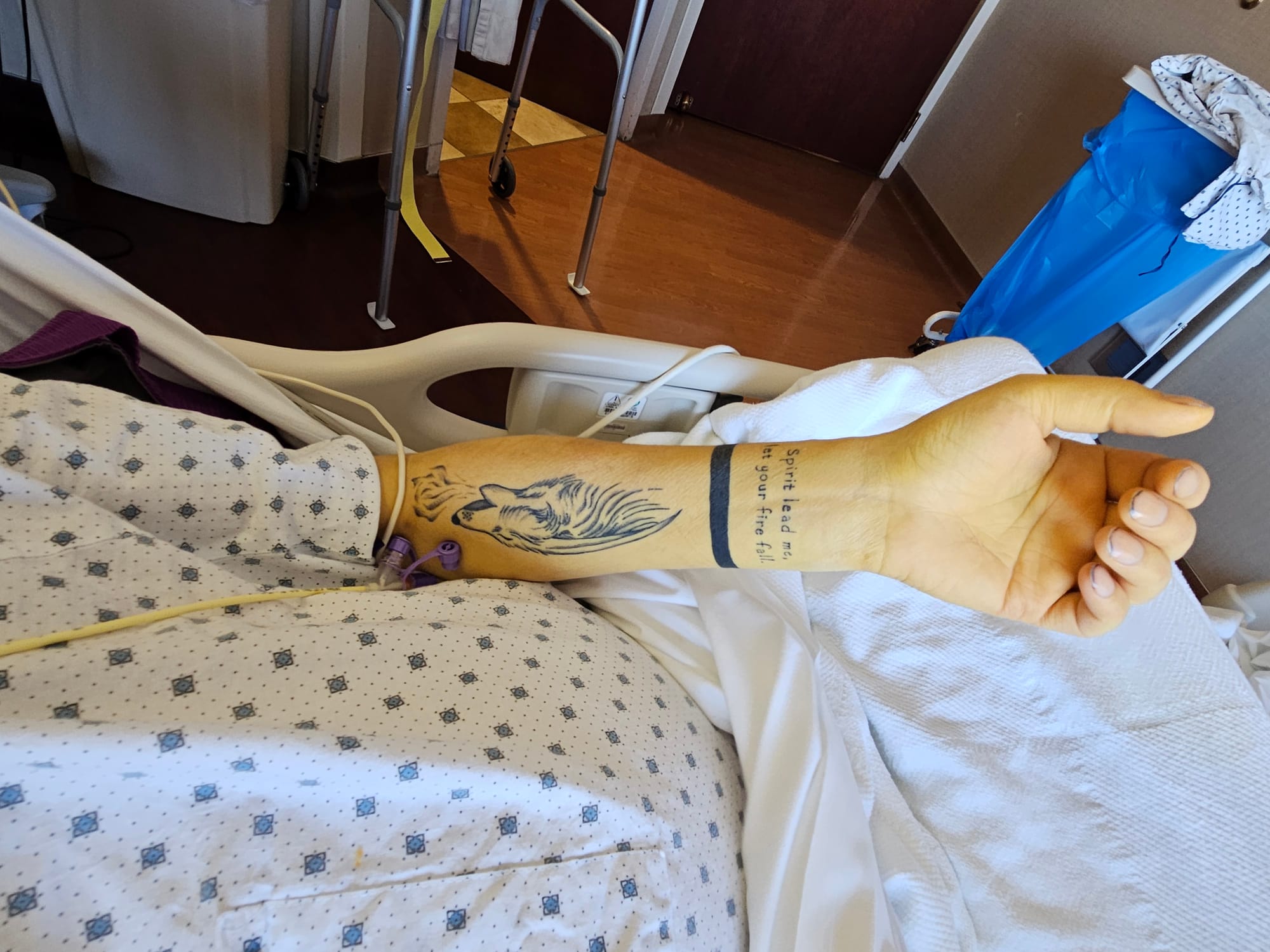Alcohol's impact: 35, dry and dying while waiting for a transplant